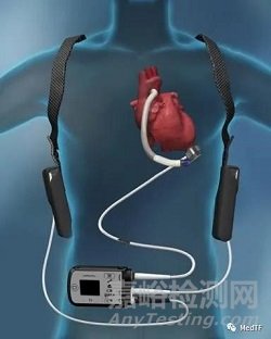 CardiacBooster Device：流量最大的心脏泵