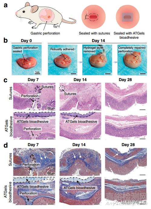 可用于胃穿孔修复的极强耐酸性水凝胶生物粘附剂