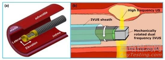 冠脉血管疾病的三大评估器械：IVUS、OCT、FFR