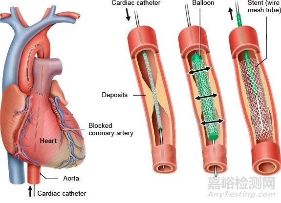 冠脉血管疾病的三大评估器械：IVUS、OCT、FFR