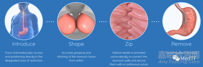 endozip：自动缝合器-一款减肥神器