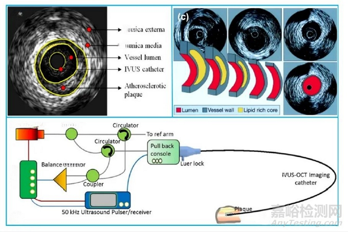 血管内超声（IVUS）设计原理、装配结构、和成像常见问题分析