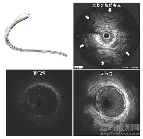 血管内超声（IVUS）设计原理、装配结构、和成像常见问题分析