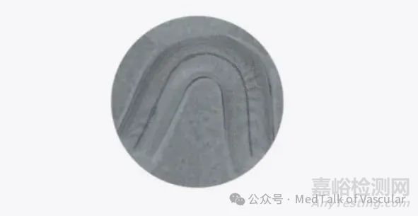 国产首款新型涂层血流导向密网支架技术解析