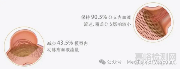 国产首款新型涂层血流导向密网支架技术解析