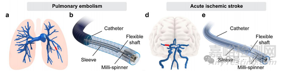 【创新医械】Milli-Spinner：能将血栓体积缩小95%取栓神器，首过再通率超90%