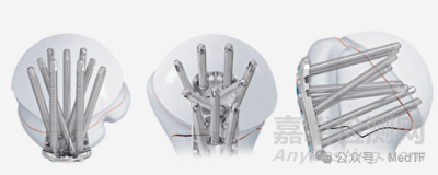 VOLT：强生推出全新的骨折内固定系统