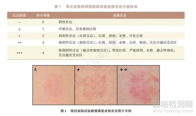 4093例样品单次皮肤封闭型斑贴试验结果回顾性研究