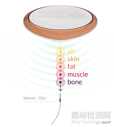 【创新医械】Neuspera：首款微型骶骨神经刺激器获批FDA，打破美敦力、波科在急迫性尿失禁垄断