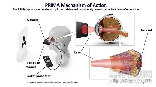 【创新医械】Prima：恢复失明者视力的脑机接口