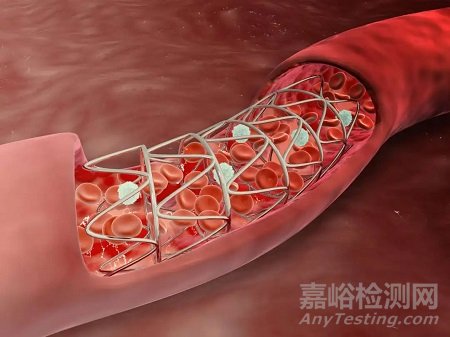 【创新医械】可吸收纤颤支架治疗下肢缺血