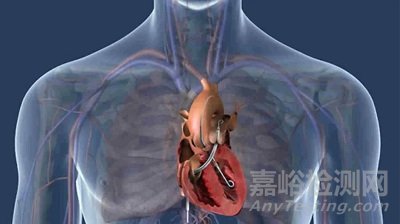 介入式人工心脏技术、产品与市场分析