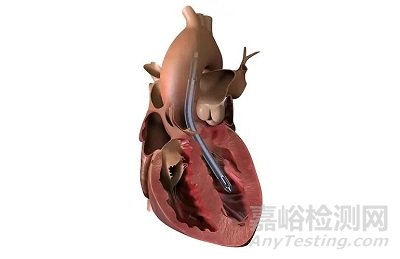 介入式人工心脏技术、产品与市场分析