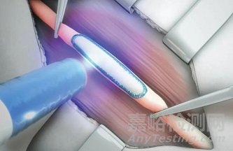 全球首个免缝合周围神经修复平台获批FDA