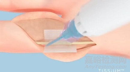 全球首个免缝合周围神经修复平台获批FDA
