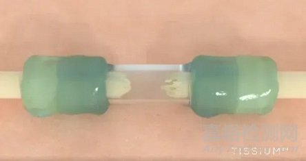 全球首个免缝合周围神经修复平台获批FDA