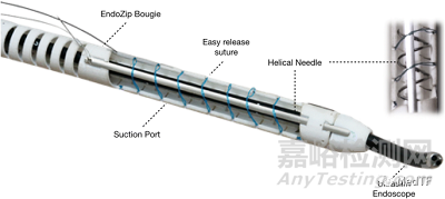 EndoZip：自动缝合减肥神器获FDA批准进行IDE研究