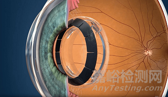 Ocumetics 可调节人工晶状体启动首次人体试验 