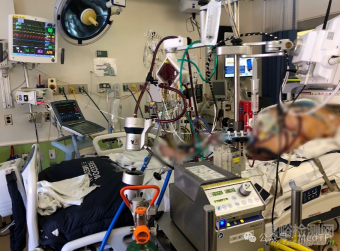 【创新医械】CDX：仅8斤重的可穿戴ECMO