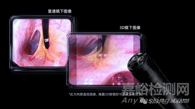 【创新医械】AQ-400：首款3D超高清软镜系统获批上市